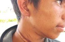 Adolescente quase é degolado