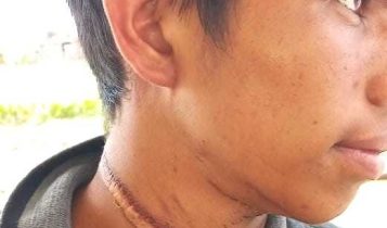 Adolescente quase é degolado