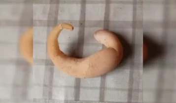 Galinha bota ovo em formato incomum e intriga moradores; Veja