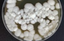 Com edição genética, fungo ganha mais eficácia no controle de pragas agrícolas